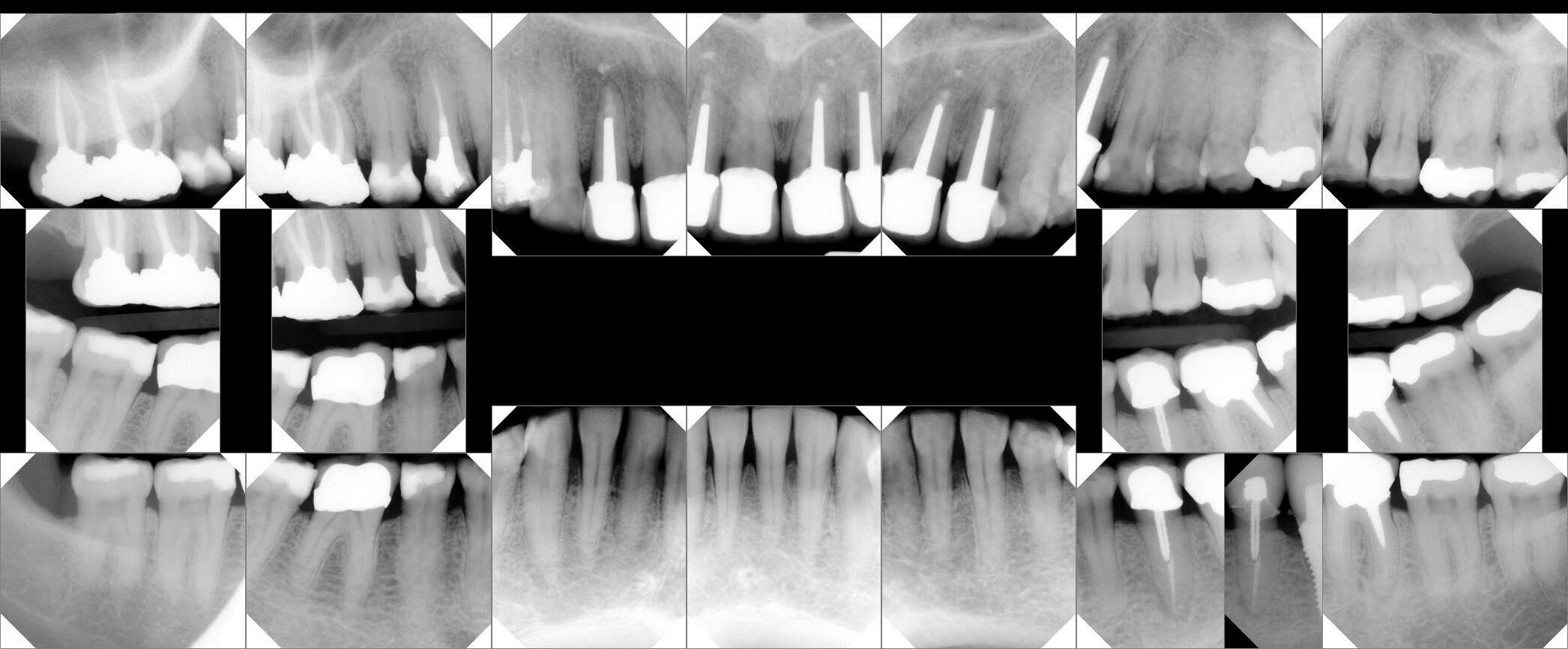 dental radiology fmx